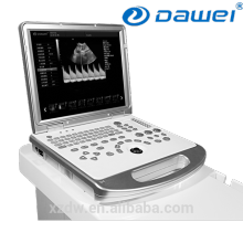 Type portatif puissant d&#39;équipement d&#39;ultrason de doppler d&#39;ultrason de 3d 4d